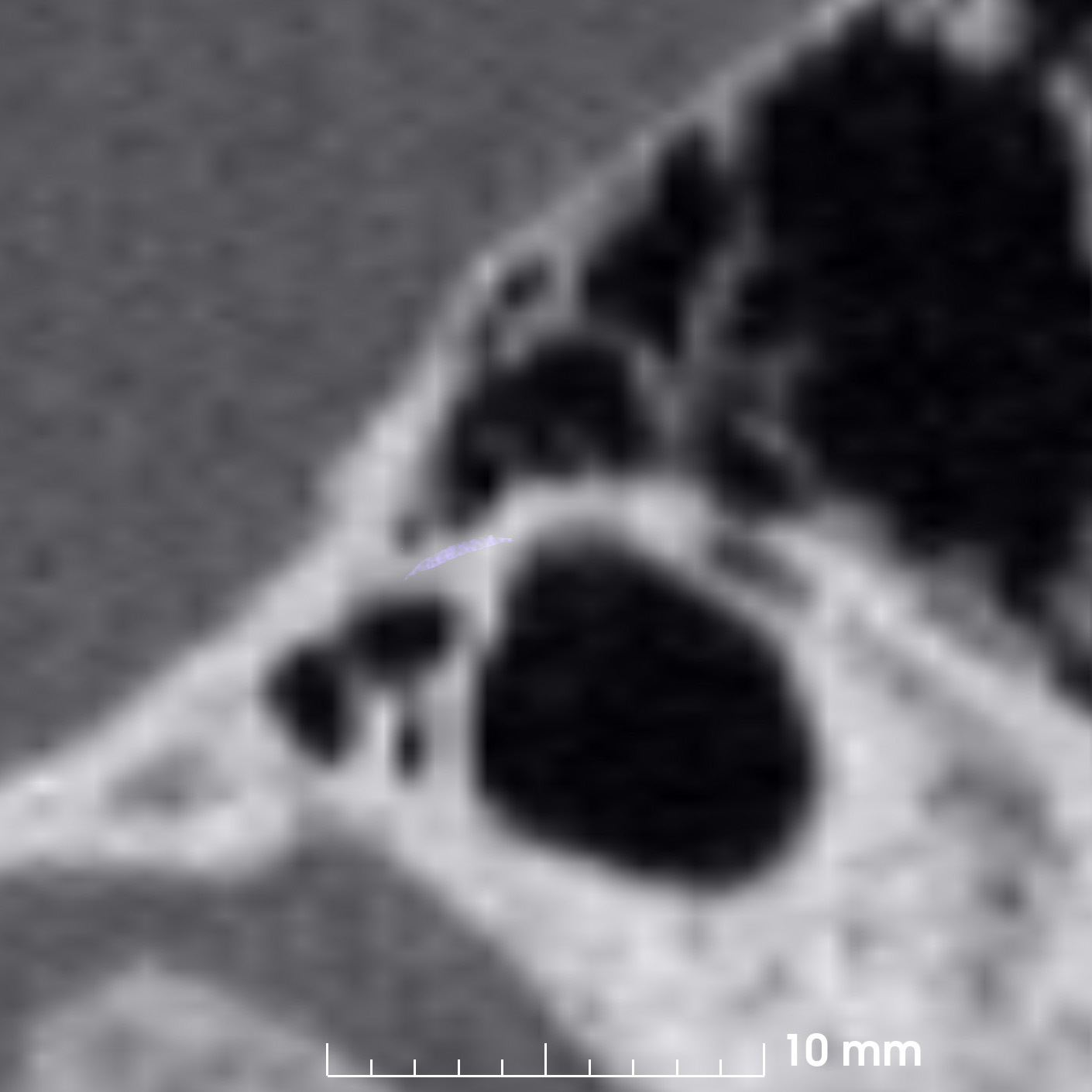 case2-sagittal